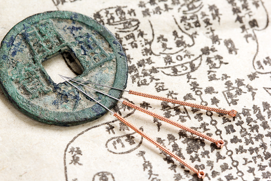 Cracked Your Back? Here Are The Benefits/Ailments Of Acupuncture Treats